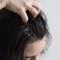 penggunaan produk rambut yang tidak cocok juga bisa menjadi pemicu ketombe. /copyriht freepik