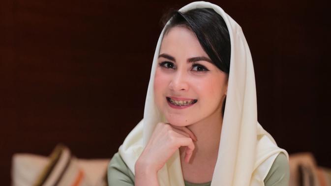 Mengagumkannya Wajah Arumi Bachsin Di Masa Kecil Showbiz Liputan6 Com