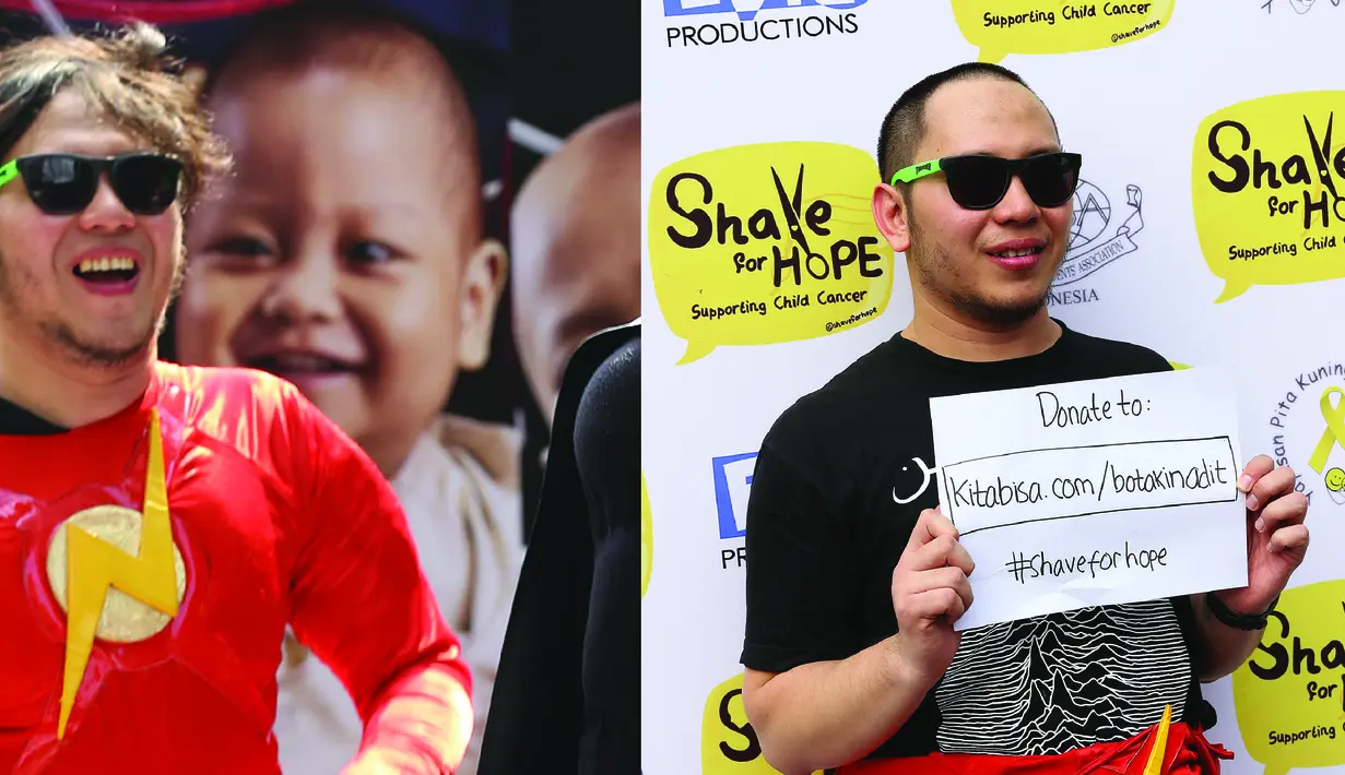 'Aku rela menjadi botak agar anak-anak pasien kanker bisa terus tersenyum,' kata Adit Insomnia. (Galih W. Satria/Bintang.com)