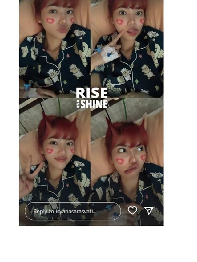 6 Potret Kondisi Isyana Sarasvati yang Tengah Jalani Perawatan, Didiagnosis Idap Lupus