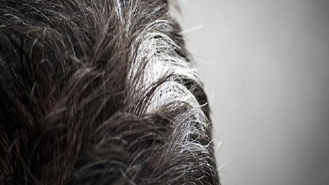 Patut Dicoba Ramuan Ini Ampuh Basmi Uban Secara Alami Citizen6 Liputan6 Com