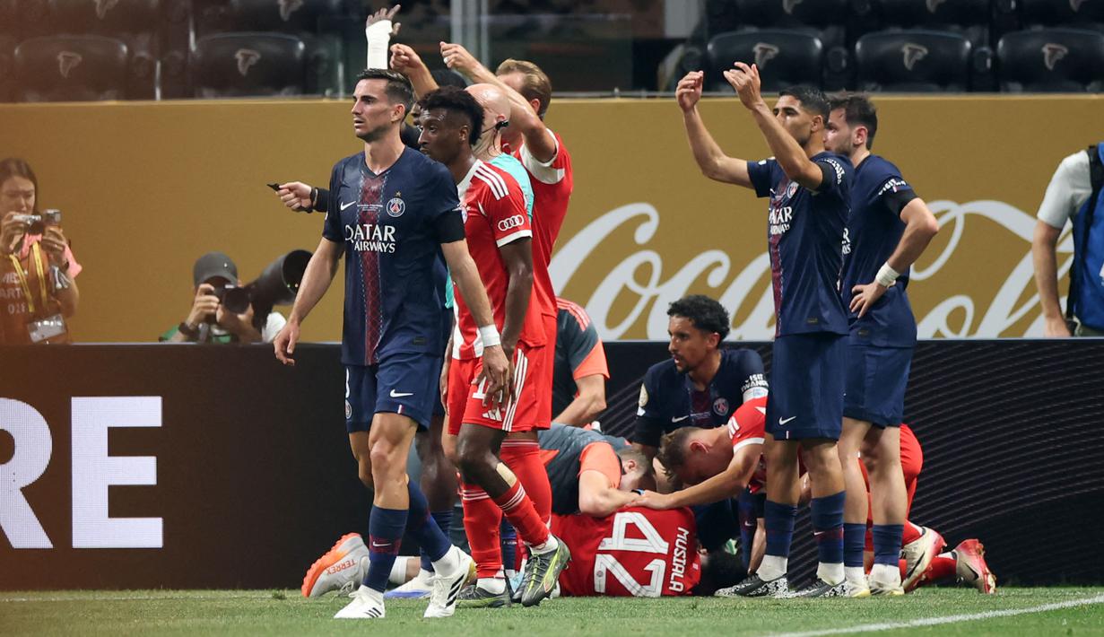 Kekalahan mereka bahkan terasa lebih menyakitkan karena dibayangi oleh cedera horor yang menimpa bintang andalan mereka, Jamal Musiala. (AFP/Alex Grimm)