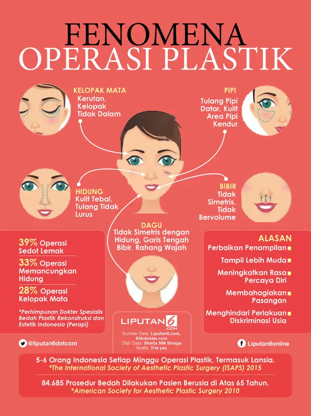 Infografis Fenomena Operasi Plastik (Liputan6.com/Triyasni)