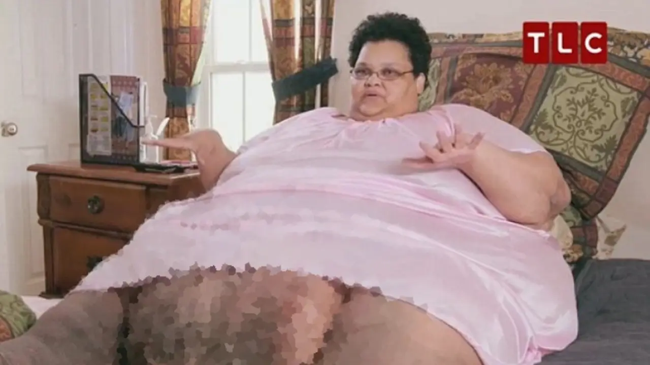 Berbobot 340 Kg, Wanita Malang Ini Tak Bisa Jalan Selama 2 Tahun