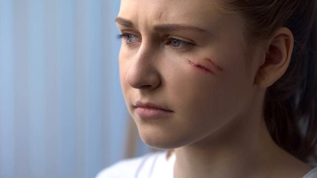 Cara Menghilangkan Bekas Luka di Wajah