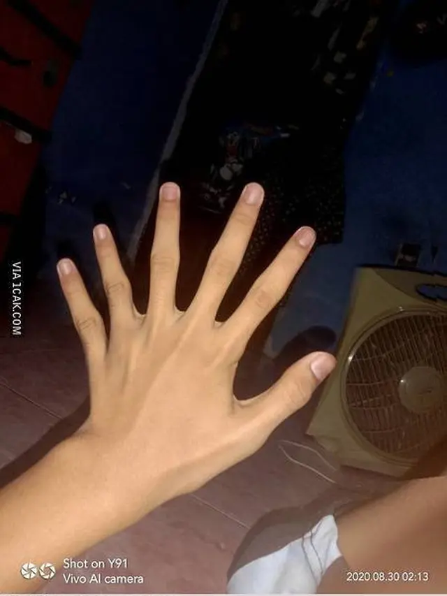 6 Editan Foto Bagian Tangan Ini Absurd Banget, Enggak Habis Pikir