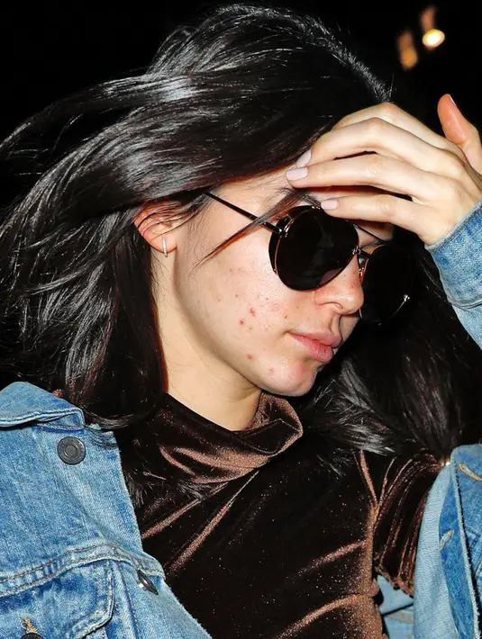 Melihat foto Kendall Jenner yang dipenuhi jerawat, seorang fans merasa senang. Bukan karena wajah idolanya tersebut menjadi kurang menarik, namun karena keberanian Kendall. (amyspagnola)