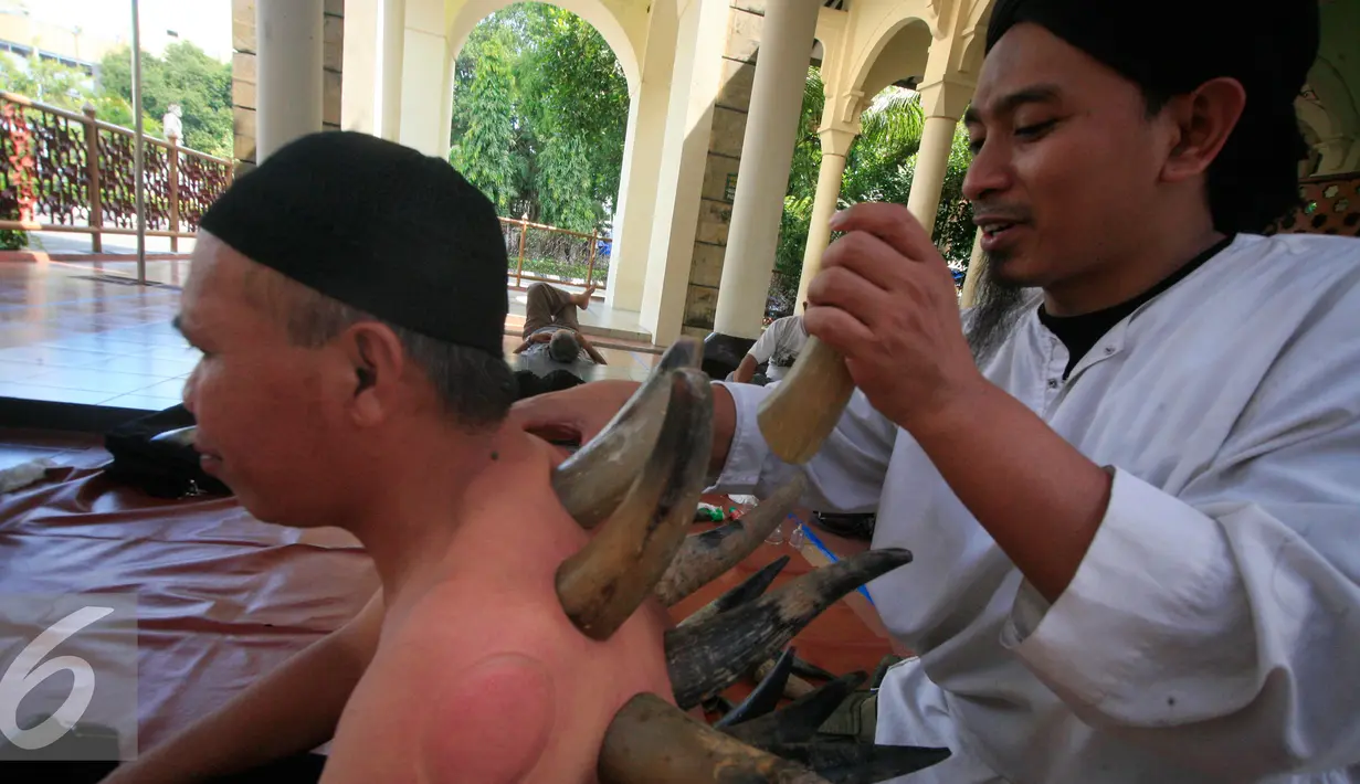 Terapis menempelkan tanduk ke punggung pasiennya di Masjid Malioboro, Yogyakarta, Minggu (17/4). Bekam yang menggunakan tanduk tersebut merupakan pengobatan alternatif yang berkhasiat untuk mengobati berbagai macam penyakit. (Liputan6.com/Boy Harjanto)