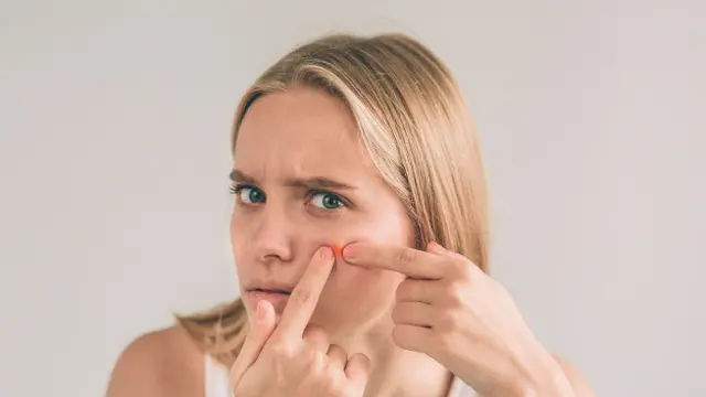 Munculnya Jerawat, Komedo, dan Flek Hitam