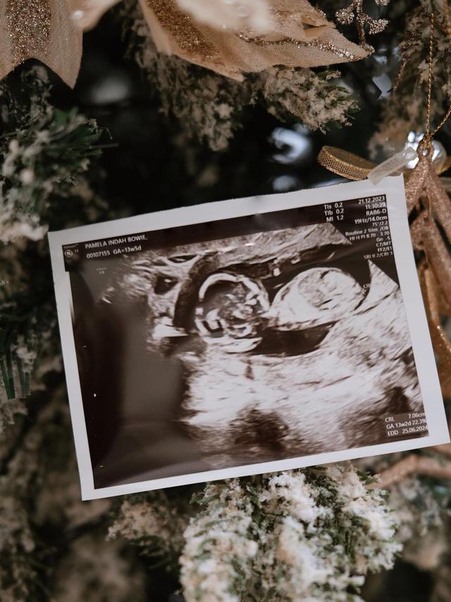 Foto USG kehamilan Pamela Bowie