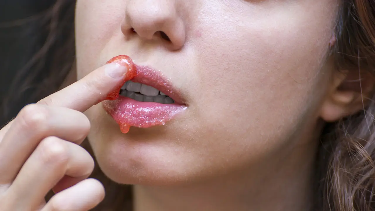 Eksfoliasi Bibir Hitam agar Kembali Pink Merona, Cari Tahu Triknya!