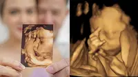 6 Pose Unik Anak Seleb saat di USG, Calon Bayi Cut Meyriska Bergaya Metal