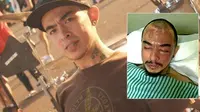 Gawat! Mata Barry Saint Loco Terinfeksi Lagi
