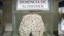 Salah satu otak manusia yang diawetkan di Museum Neuropatologi, di Rumah Sakit Santo Toribio de Mogrovejo, Lima, Peru (16/11). Neuroptologi adalah adalah sebuah subspesialisasi patologi yang berhubungan dengan penyakit otak. (AFP Photo/Ernesto Benavides)