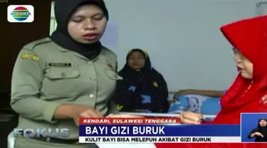 Menurut sang ibu, dia memberikan susu kental manis karena tak sanggup beli susu bayi yang harganya sangat mahal.