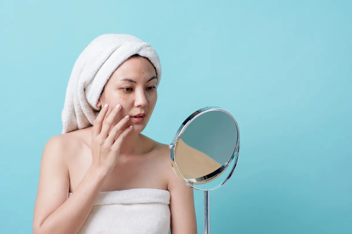 Skincare Wajah Hiperpigmentasi untuk Usia 30-an, Cek Perawatan Penting yang Nggak Boleh Dilewatkan