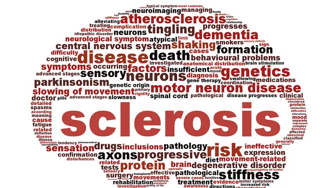 Mengenal Multiple Sclerosis, Penyakit Pepeng Jari-jari