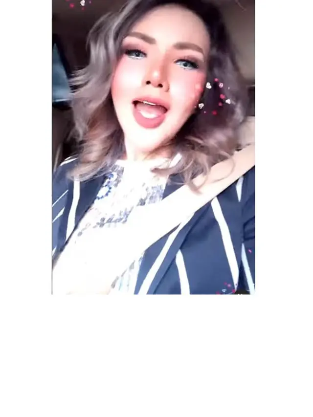 Makin Mancung, Ini 8 Potret Barbie Kumalasari Pasca Operasi Hidung Senilai Rp 50 Juta