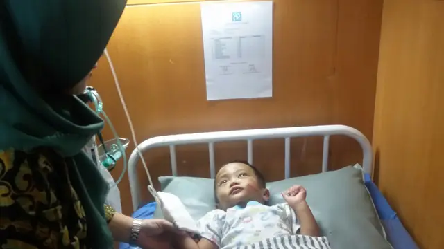 Luka Bakar di Wajah Balita, Akibat Penganiayaan Tante?
