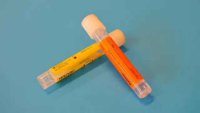 Asam Urat dalam Tubuh