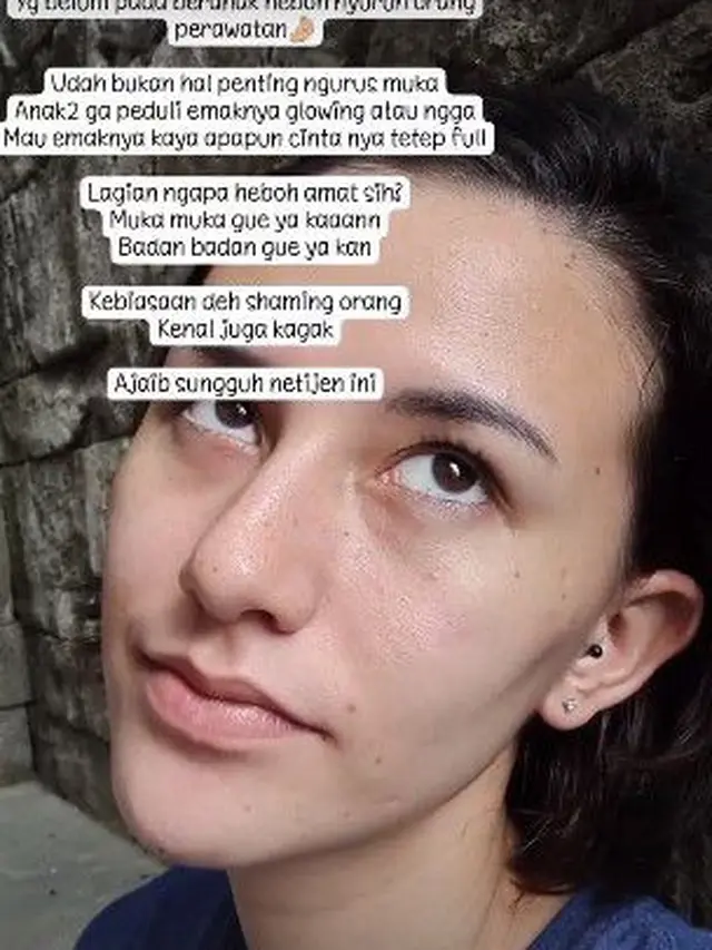 Wajahnya Dicibir Banyak Komedo, Ini 6 Potret Dahlia Poland Tanpa Makeup