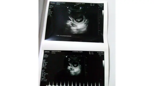 ramadan 2021 dan kehamilan pertama