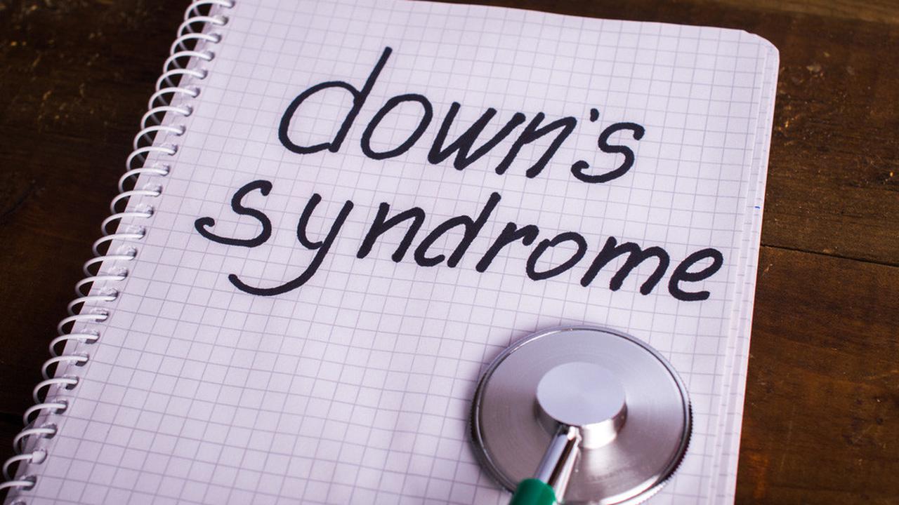 6 Masalah Kesehatan yang Menimpa Anak Down Syndrome (MsMaria/Shutterstock)