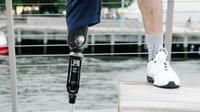 Iliustrasi Berujung pada Amputasi dan Disabilitas, Ini Alasan Luka pada Pasien Diabetes Melitus Jarang Disadari. Foto: Lara Jameson, Pexels.