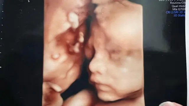 Unggah Foto USG, Anak Kedua Nella Kharisma dan Dory Jadi Pusat Perhatian Netizen