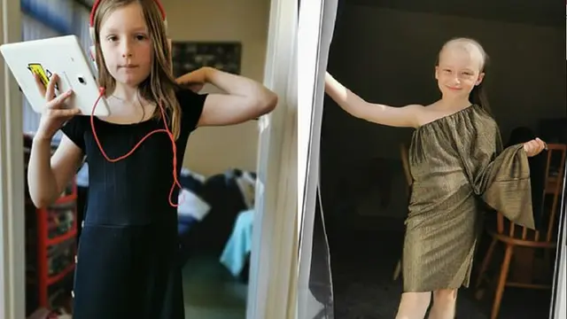 Seorang gadis berusia 8 tahun mengalami stres akibat lockdown yang membuatnya mencabuti bulu mata hingga rambutnya hingga hampir botak/dok. News Agency