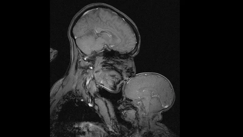 Hasil MRI Ini Tujukkan Kekuatan Otak Ibu Dan Anak