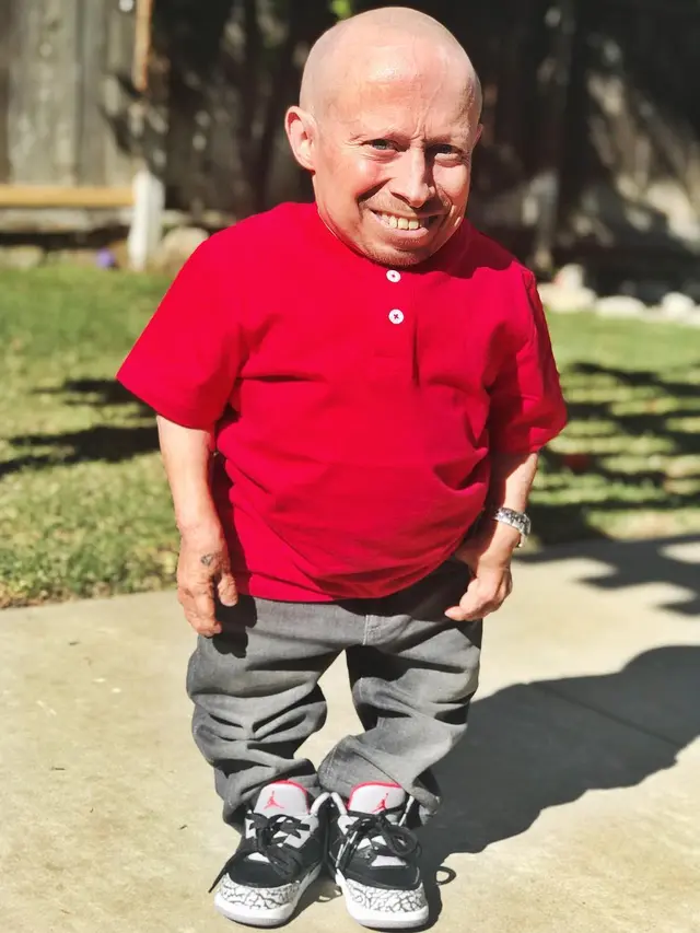 [Bintang] Pemeran Mini-Me di Austin Powers, Verne Troyer Meninggal Dunia