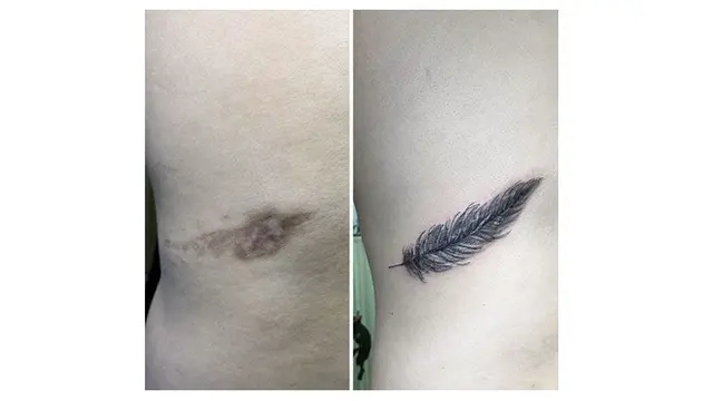 Wanita Ini Kreasikan Bekas Luka dengan Tato, 7 Hasilnya Mengagumkan