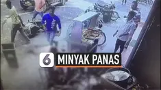Bocah 5 tahun dan kakeknya alami luka bakar setelah sepeda motor yang ditumpangi menabrak kuali berisi minyak goreng panas. Insiden ini terjadi karena sang bocah menarik tuas gas motor.
