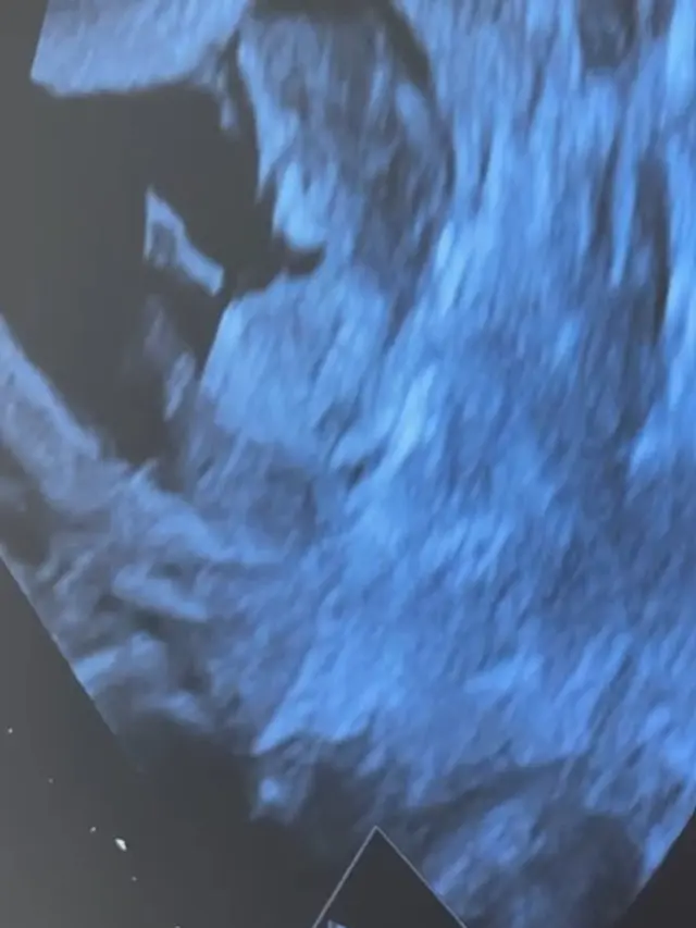 Shanju dan Jonatan Christie (Instagram/shanju)