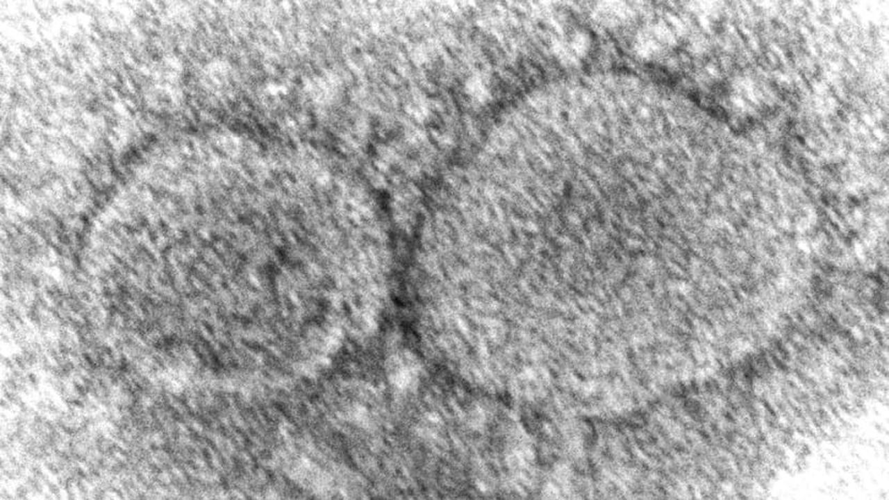 Partikel Virus Corona, SARS-CoV-2, yang menyebabkan COVID-19. (Gambar: Hannah A Bullock, Azaibi Tamin/CDC via AP)