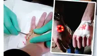  Seorang penggemar gadget dan karakter superhero Iron Man ini rela mengiris punggung tangannya agar punya chip yang bisa bersinar dari bawah kulitnya. (Sumber: YouTube (c) Bird Machine)