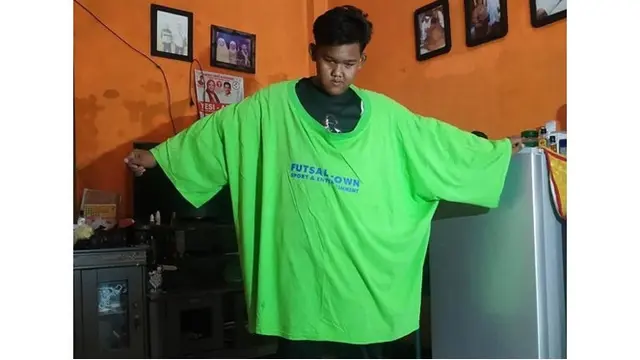 6 Potret Kabar Arya Permana Bocah Obesitas Hampir 200 Kg, Kini Kurus dan Bugar