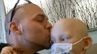 Demi berbela rasa dengan anaknya yang kanker, seorang ayah memasang tato di kepala dengan bentuk mirip bekas bedah kepala anaknya. (Sumber BBC)