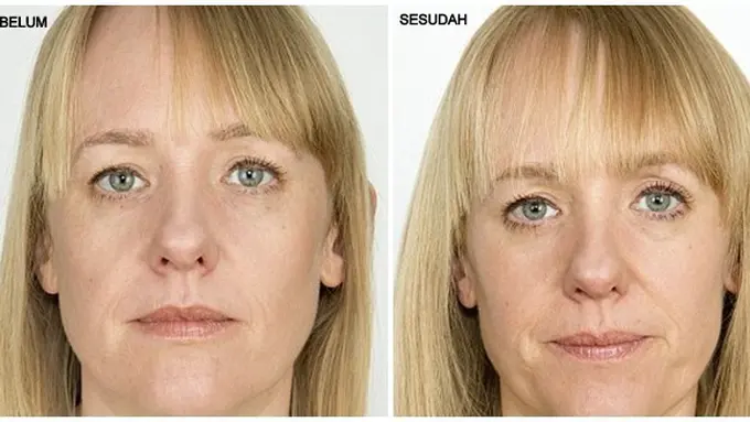 Foto : copyright dailymail.co.uk