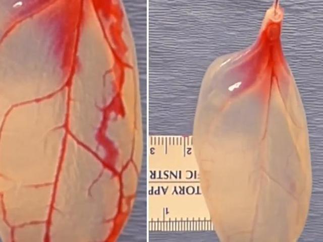 Ilmuwan Tumbuhkan Jantung Manusia Di Selembar Daun Bayam Global Liputan6 Com