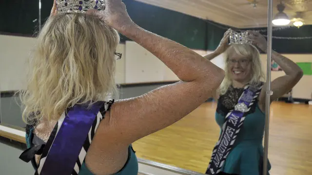 [Bintang] 5 Potret Gadis Bersisik yang Kini Jadi Ratu Kecantikan