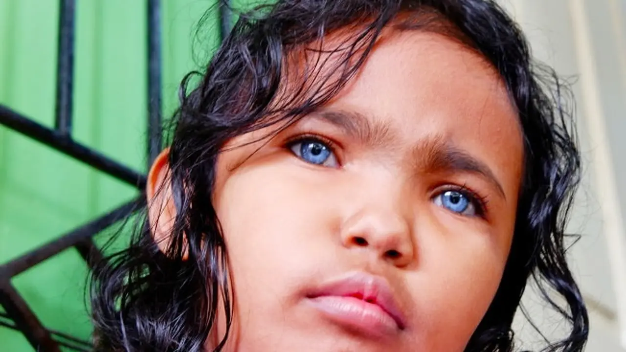 Dzakira Azizy Naqiya, anak bermata biru di Pekanbaru.