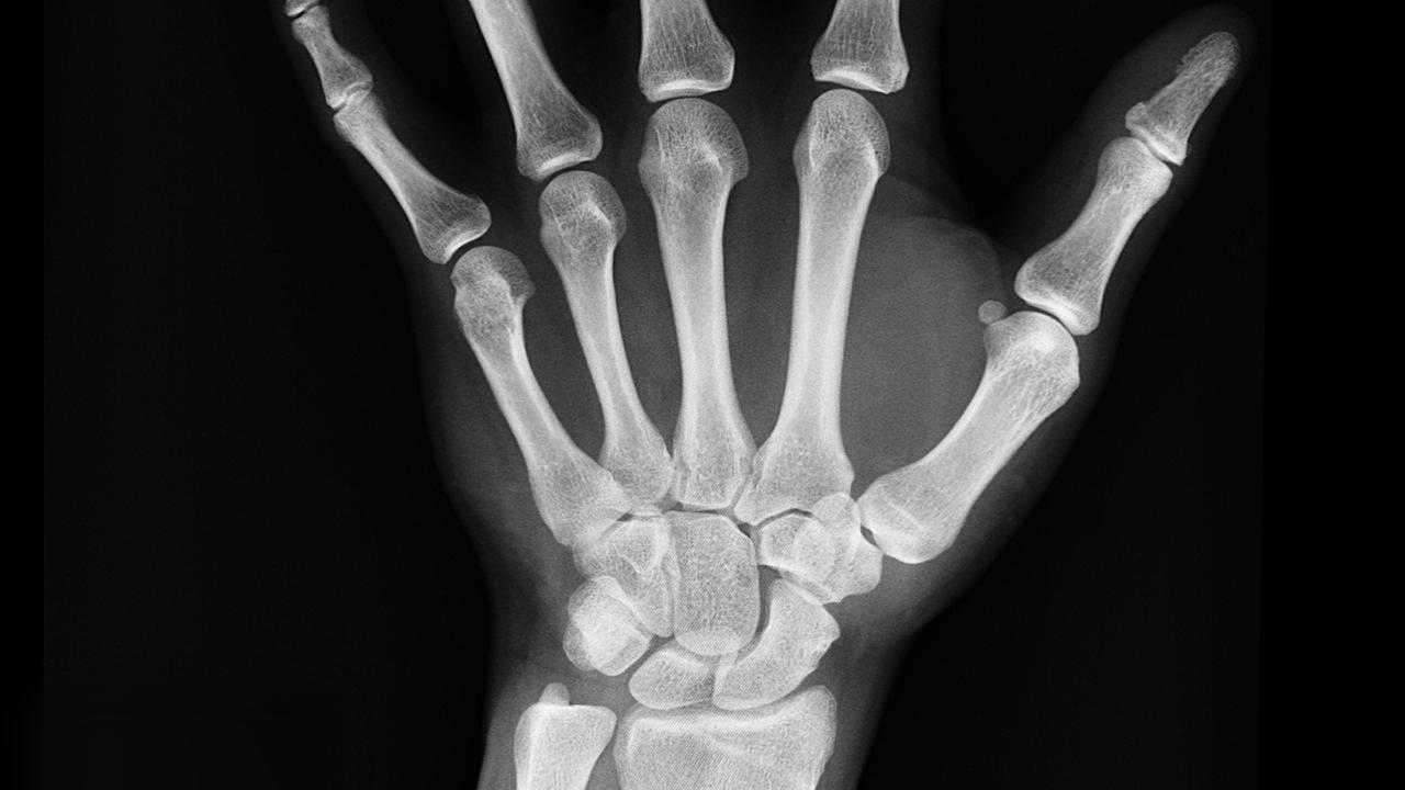 Fungsi Tulang Telapak Tangan