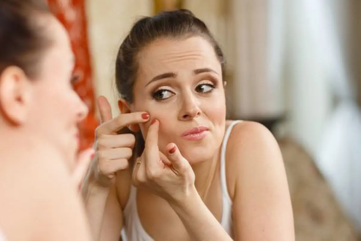 Duh, muka kok jerawatan sih?/Copyright shutterstock.com