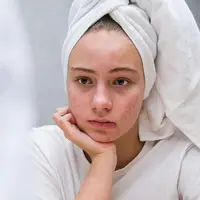 Ilustrasi kulit wajah gradakan. (c) junne12/Depositphotos.com