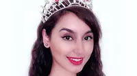 Runner Up Miss England 2019 Pratishtha Raut sempat dilarikan ke rumah sakit akibat sengatan ubur-ubur (dok. Instagram/@thris.raut/https://www.instagram.com/p/B8QZPoOBs_A/Komarudin)