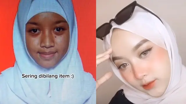Viral Curahan Hati Wanita Dulu Sering Dibully Fisik, Transformasinya Kini Bikin Pangling