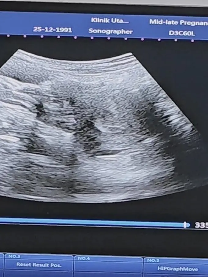 Potret calon anak ketiga Alyssa Soebandono dan Dude Harlino (Sumber: Instagram/ichasoebandono dan Instagram/dude2harlino)