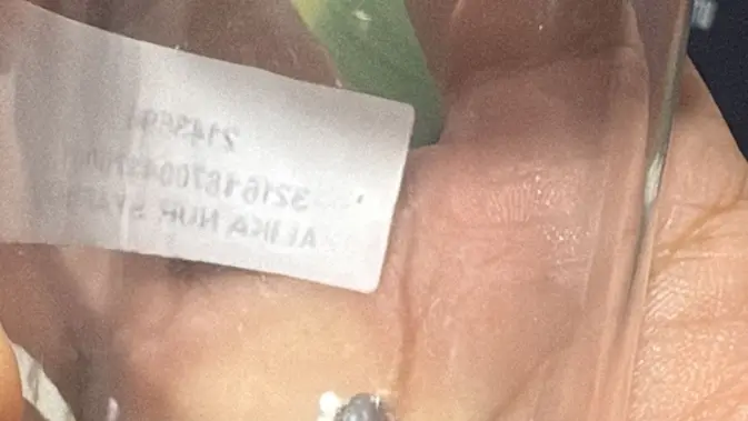 Kronologi Bocah di Bekasi Terkena Peluru Nyasar